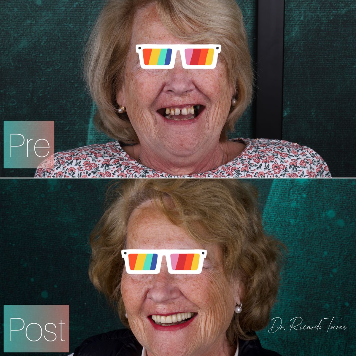 Antes y después — comparativa completa